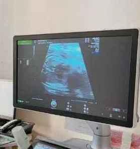 产检资料错误已入电脑，如何应对？